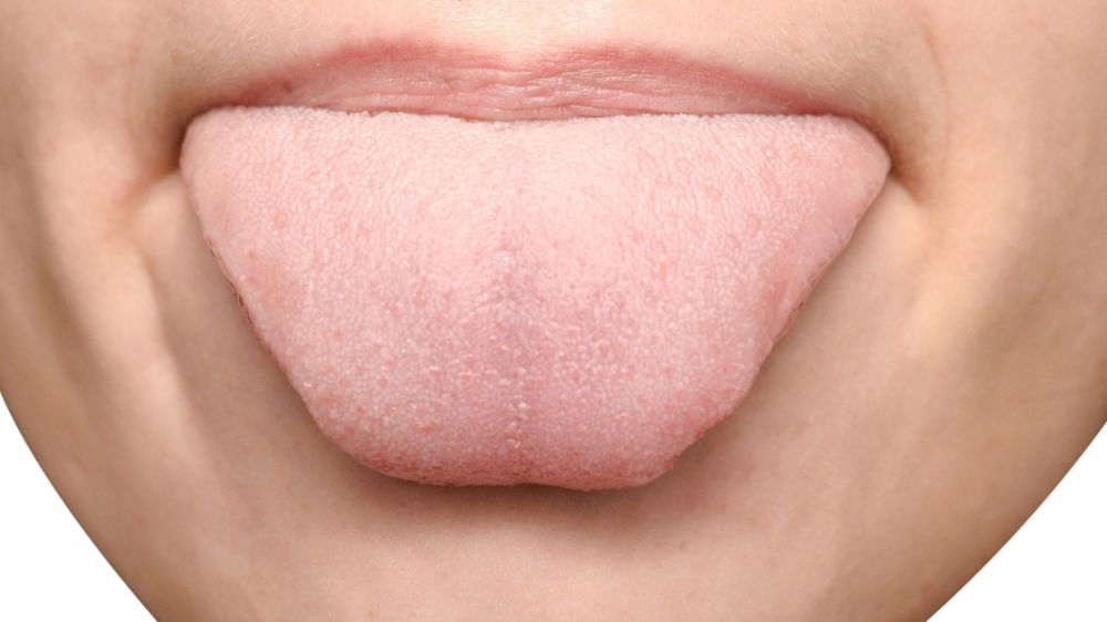 tongue diagnosis in traditional chinese medicine